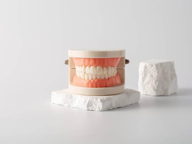 a dental model showcasing seamless crowns