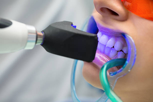 close-up shot a teeth whitening treatment